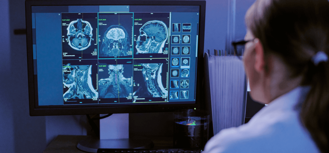 Legal Precedent for DTI Admissible in Court?